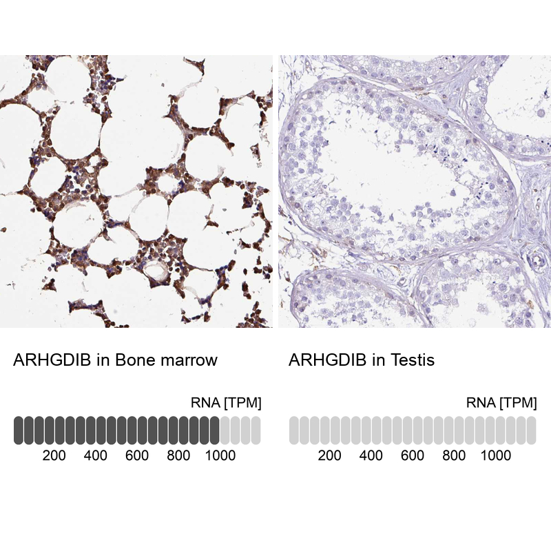 Atlas Antibodies Anti-ARHGDIB Antibody