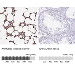 Atlas Antibodies Anti-ARHGDIB Antibody
