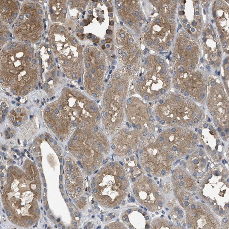 Atlas Antibodies Anti-ARHGDIA Antibody