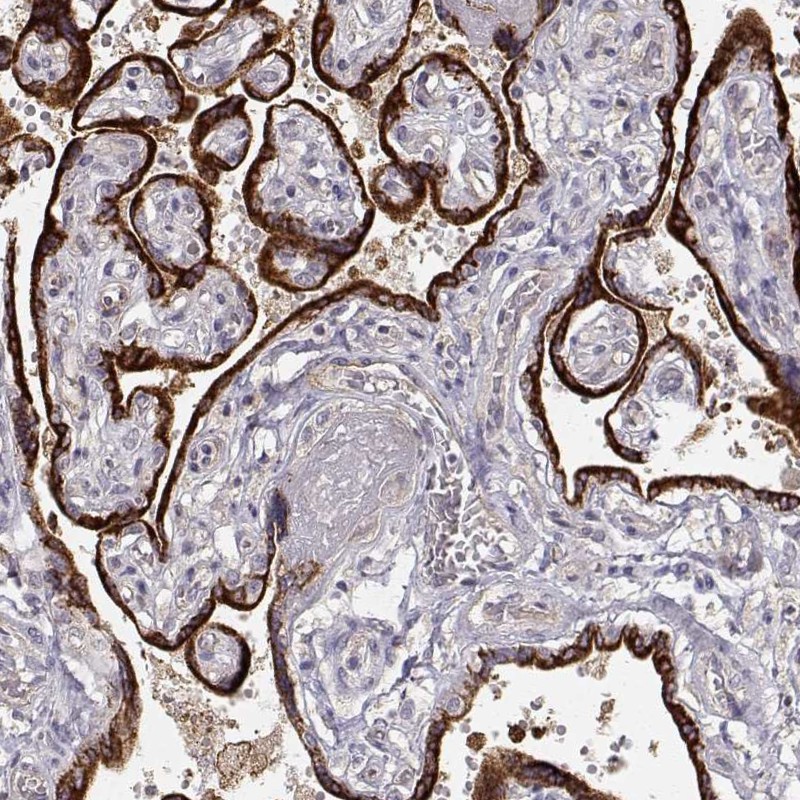 Atlas Antibodies Anti-ARHGAP8 Antibody