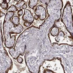 Atlas Antibodies Anti-ARHGAP8 Antibody