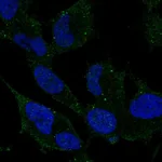 Atlas Antibodies Anti-ARHGDIG Antibody