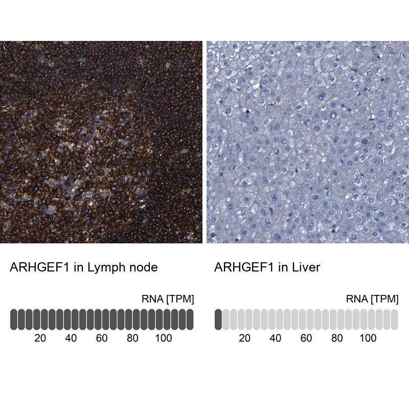 Atlas Antibodies Anti-ARHGEF1 Antibody