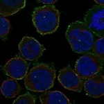 Atlas Antibodies Anti-ARHGAP9 Antibody