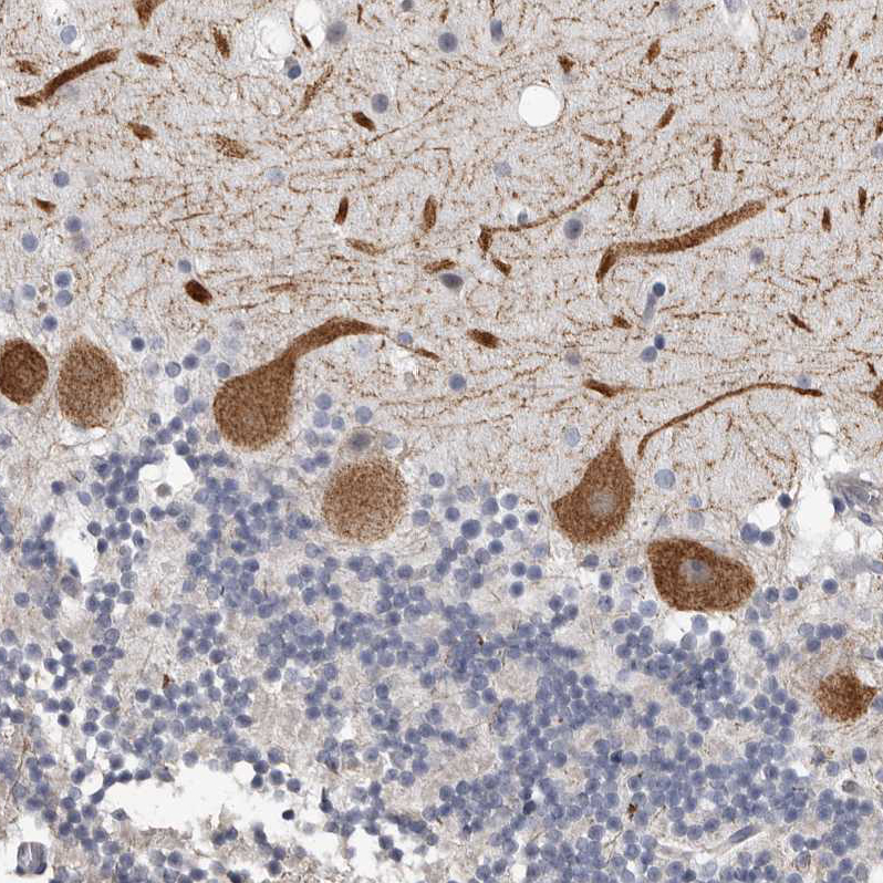 Atlas Antibodies Anti-ARHGEF10 Antibody