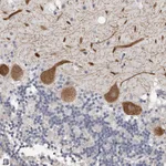 Atlas Antibodies Anti-ARHGEF10 Antibody