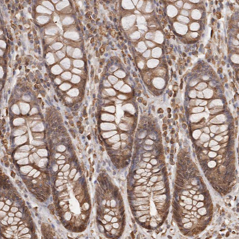 Atlas Antibodies Anti-ARHGEF10L Antibody