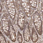 Atlas Antibodies Anti-ARHGEF10L Antibody