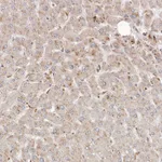 Atlas Antibodies Anti-ARHGEF10L Antibody