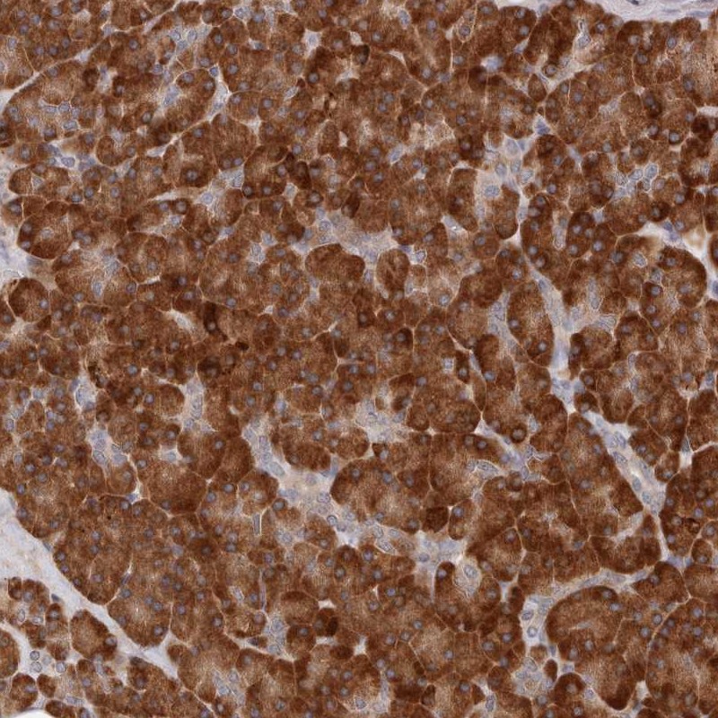 Atlas Antibodies Anti-ARHGEF10L Antibody