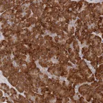 Atlas Antibodies Anti-ARHGEF10L Antibody