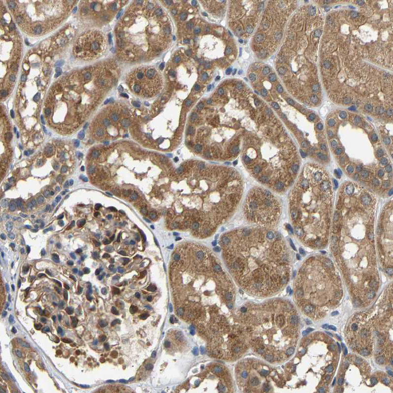 Atlas Antibodies Anti-ARHGEF12 Antibody