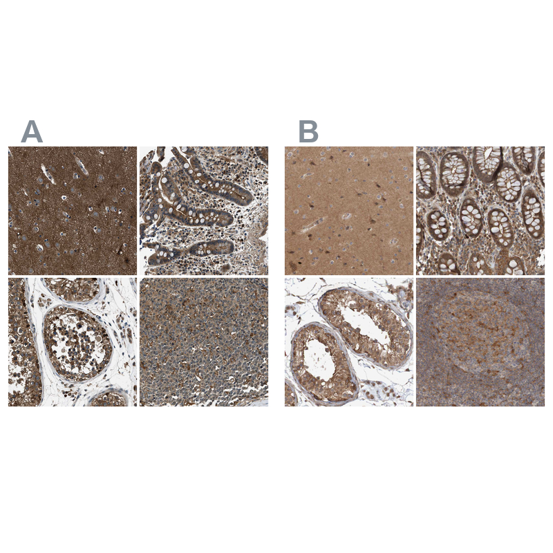 Atlas Antibodies Anti-ARHGEF11 Antibody