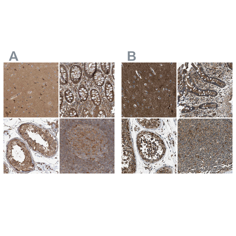 Atlas Antibodies Anti-ARHGEF11 Antibody