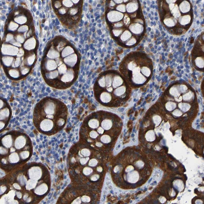 Atlas Antibodies Anti-ARHGEF16 Antibody