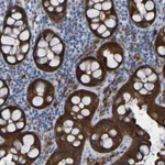 Atlas Antibodies Anti-ARHGEF16 Antibody