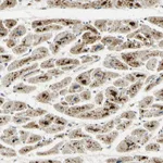 Atlas Antibodies Anti-ARHGEF17 Antibody