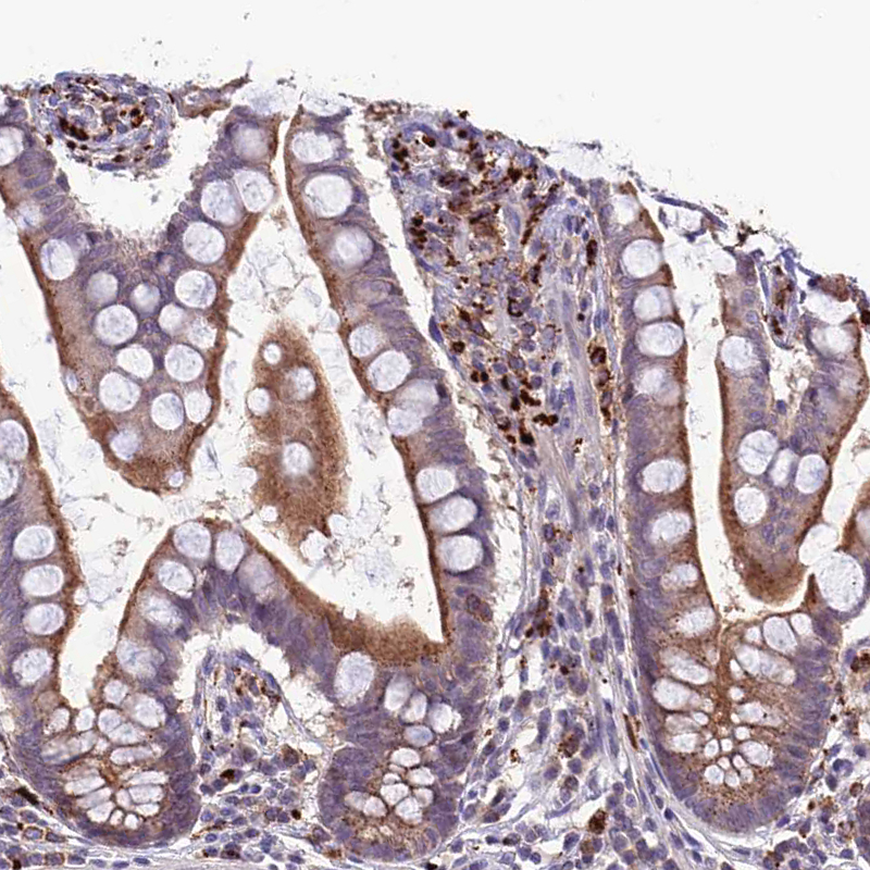 Atlas Antibodies Anti-ARHGEF18 Antibody