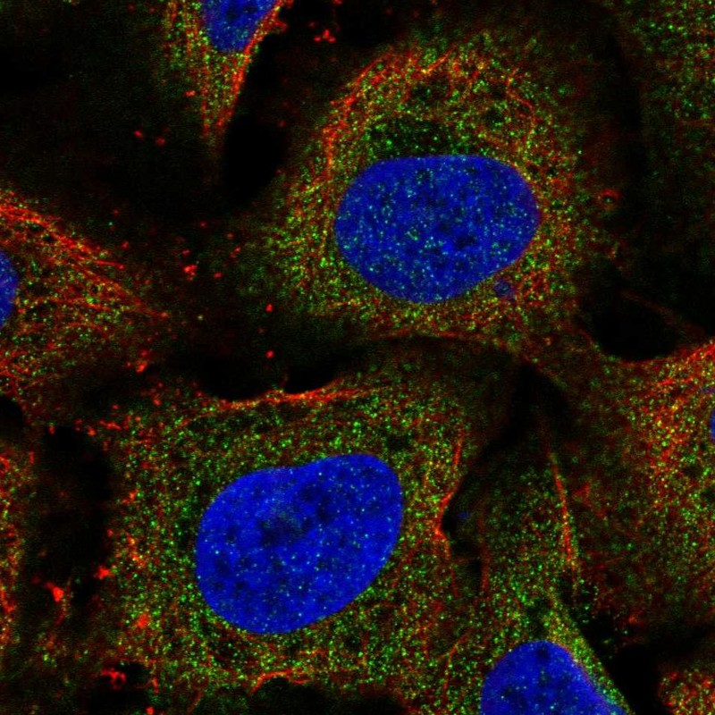 Atlas Antibodies Anti-ARHGEF18 Antibody