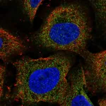 Atlas Antibodies Anti-ARHGEF18 Antibody