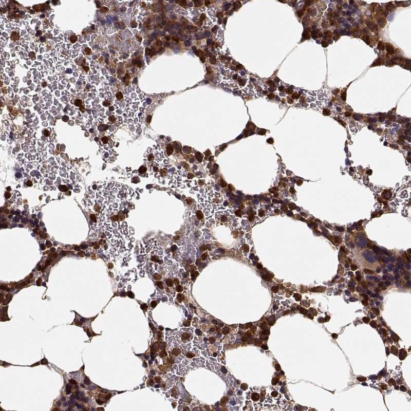Atlas Antibodies Anti-ARHGEF2 Antibody