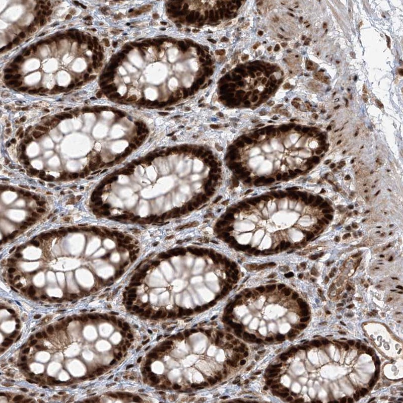 Atlas Antibodies Anti-ARHGEF3 Antibody