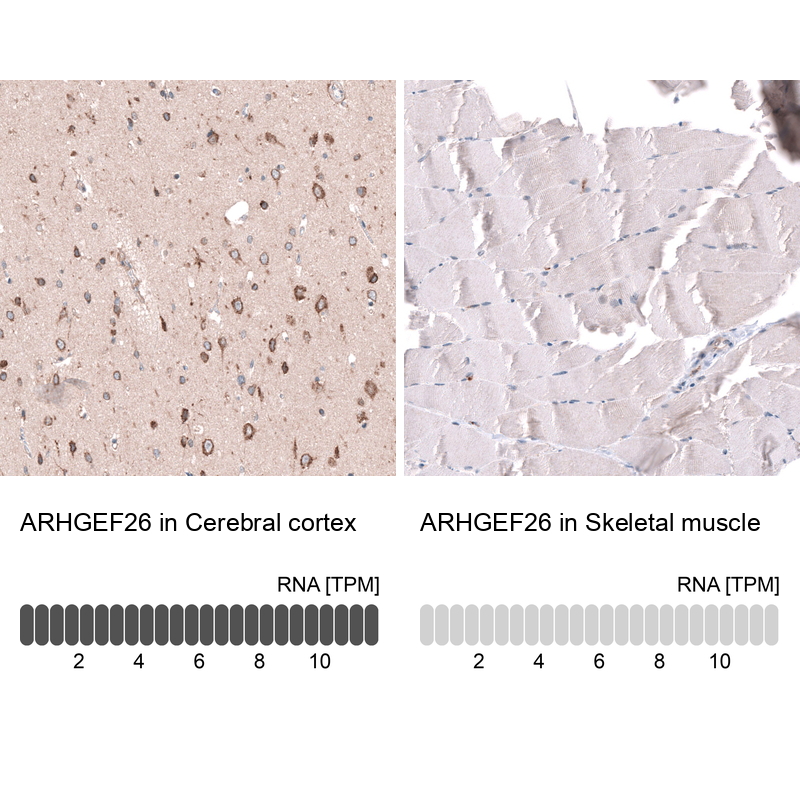 Atlas Antibodies Anti-ARHGEF26 Antibody