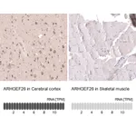 Atlas Antibodies Anti-ARHGEF26 Antibody