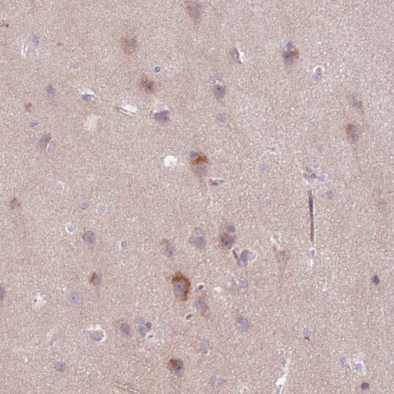 Atlas Antibodies Anti-ARHGEF25 Antibody