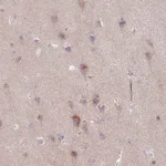 Atlas Antibodies Anti-ARHGEF25 Antibody