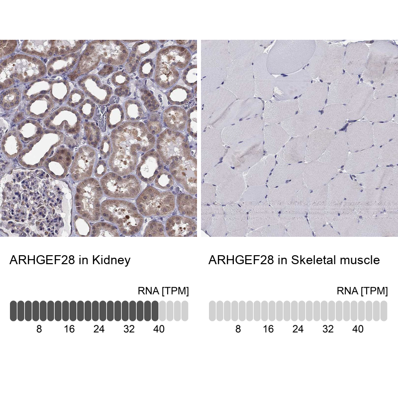 Atlas Antibodies Anti-ARHGEF28 Antibody