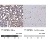 Atlas Antibodies Anti-ARHGEF28 Antibody