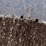 Atlas Antibodies Anti-ARHGEF33 Antibody