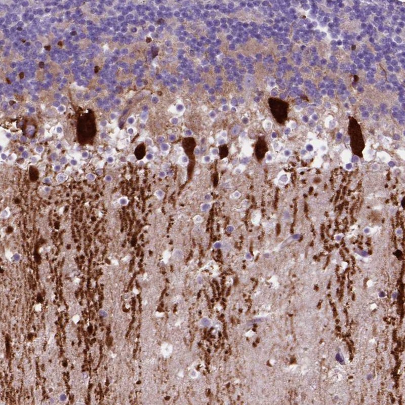 Atlas Antibodies Anti-ARHGEF33 Antibody
