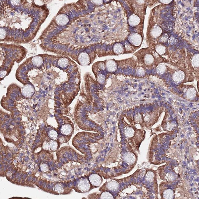 Atlas Antibodies Anti-ARHGEF35 Antibody