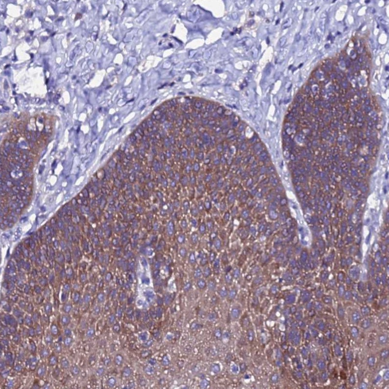 Atlas Antibodies Anti-ARHGEF35 Antibody