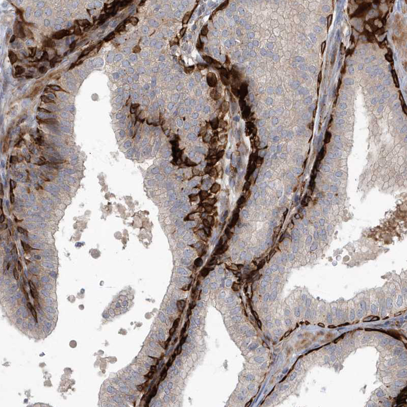 Atlas Antibodies Anti-ARHGEF38 Antibody