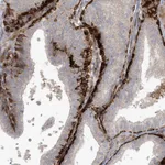 Atlas Antibodies Anti-ARHGEF38 Antibody