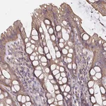 Atlas Antibodies Anti-ARHGEF39 Antibody