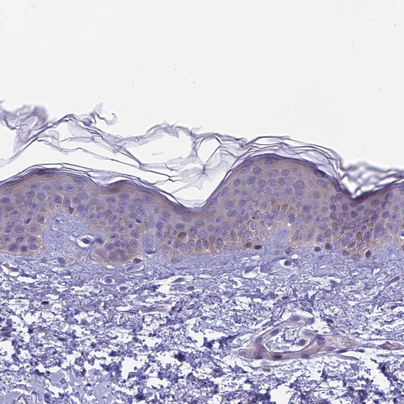 Atlas Antibodies Anti-ARHGEF37 Antibody