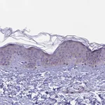 Atlas Antibodies Anti-ARHGEF37 Antibody