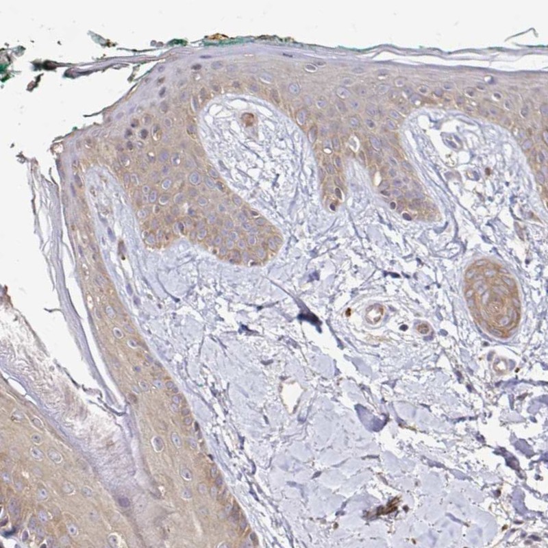 Atlas Antibodies Anti-ARHGEF37 Antibody