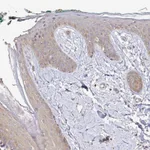Atlas Antibodies Anti-ARHGEF37 Antibody