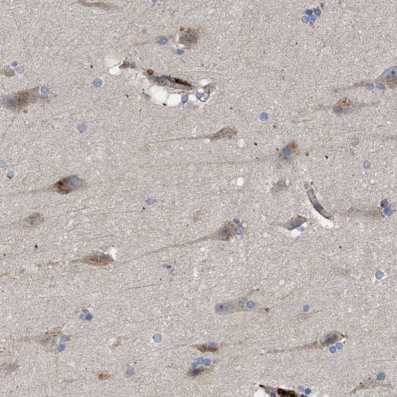 Atlas Antibodies Anti-ARHGEF4 Antibody