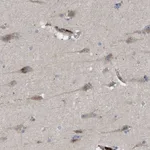 Atlas Antibodies Anti-ARHGEF4 Antibody