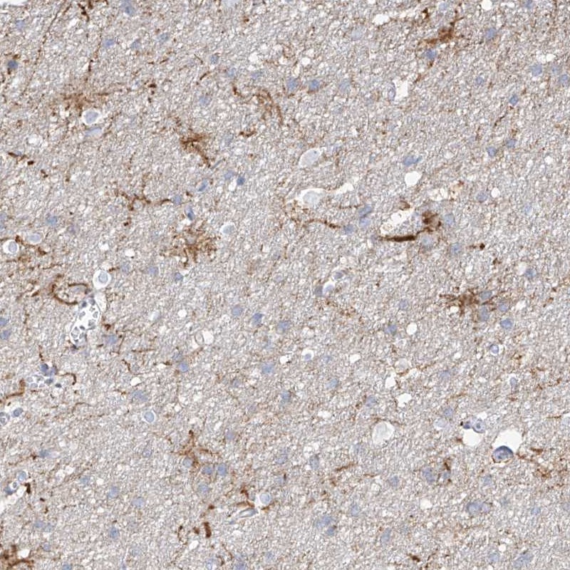 Atlas Antibodies Anti-ARHGEF40 Antibody