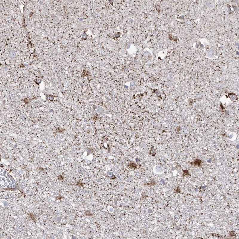 Atlas Antibodies Anti-ARHGEF40 Antibody