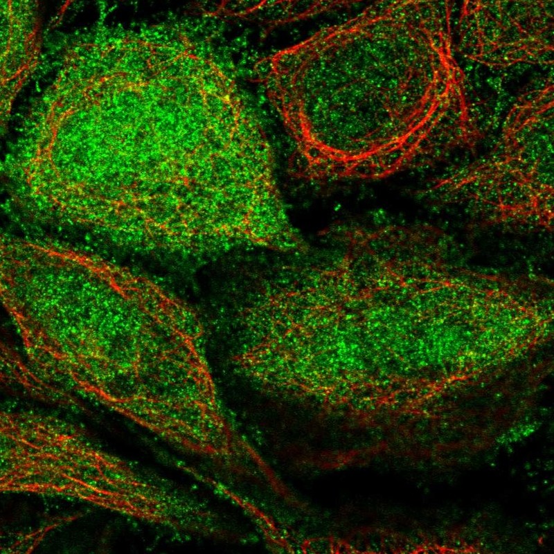 Atlas Antibodies Anti-ARHGEF5 Antibody