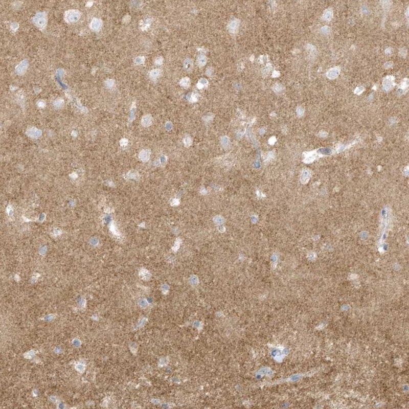 Atlas Antibodies Anti-ARHGEF9 Antibody