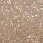Atlas Antibodies Anti-ARHGEF9 Antibody